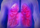 Rak płuc. Współczesna medycyna może więcej